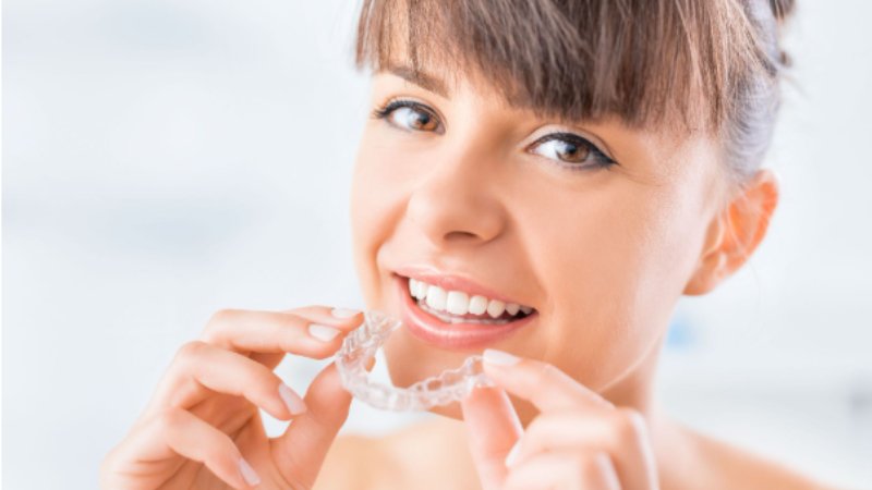 Clear Aligners